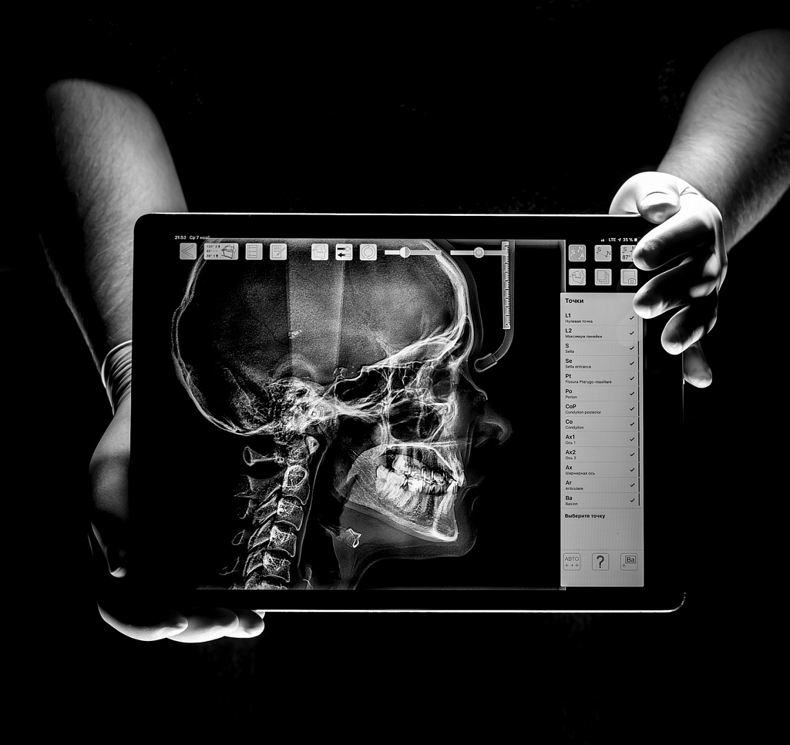 Челюстно-лицевая хирургия и комбинированное лечение сложных аномалий прикуса