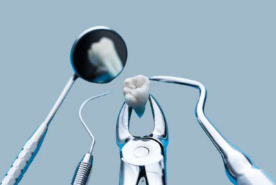 Может ли выпасть имплант?