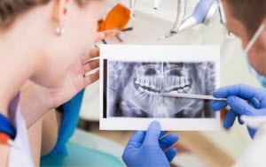 Зубные импланты - что это и зачем нужны